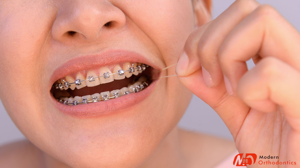 Do Braces Hurt Knowledge Base Orthodontic Aesthetic Brackets Article